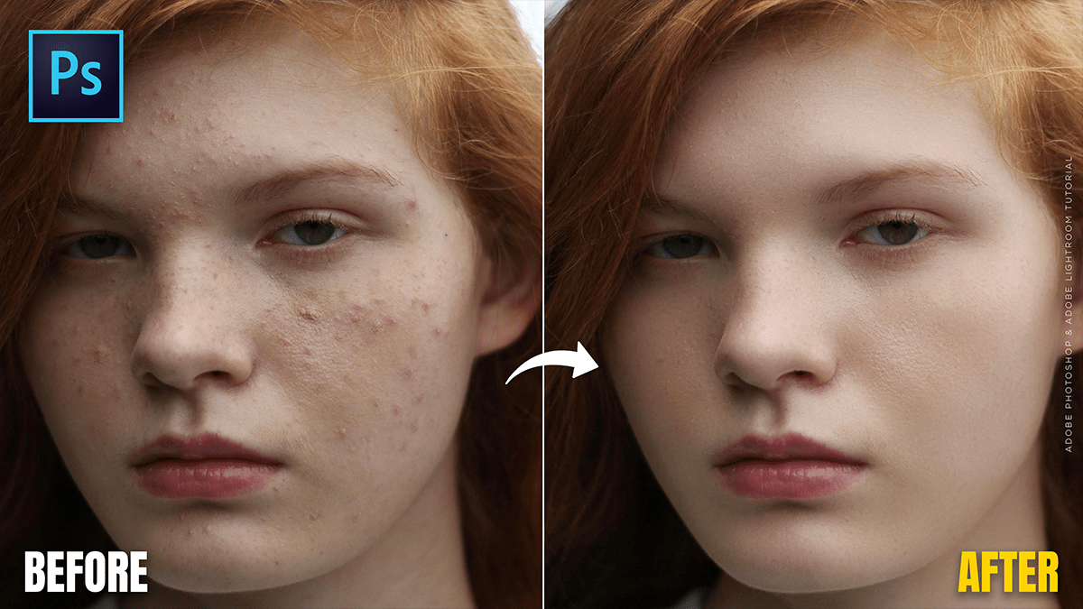 Adobe Photoshop 2026: Skin Retouching Tutorial For Beginners