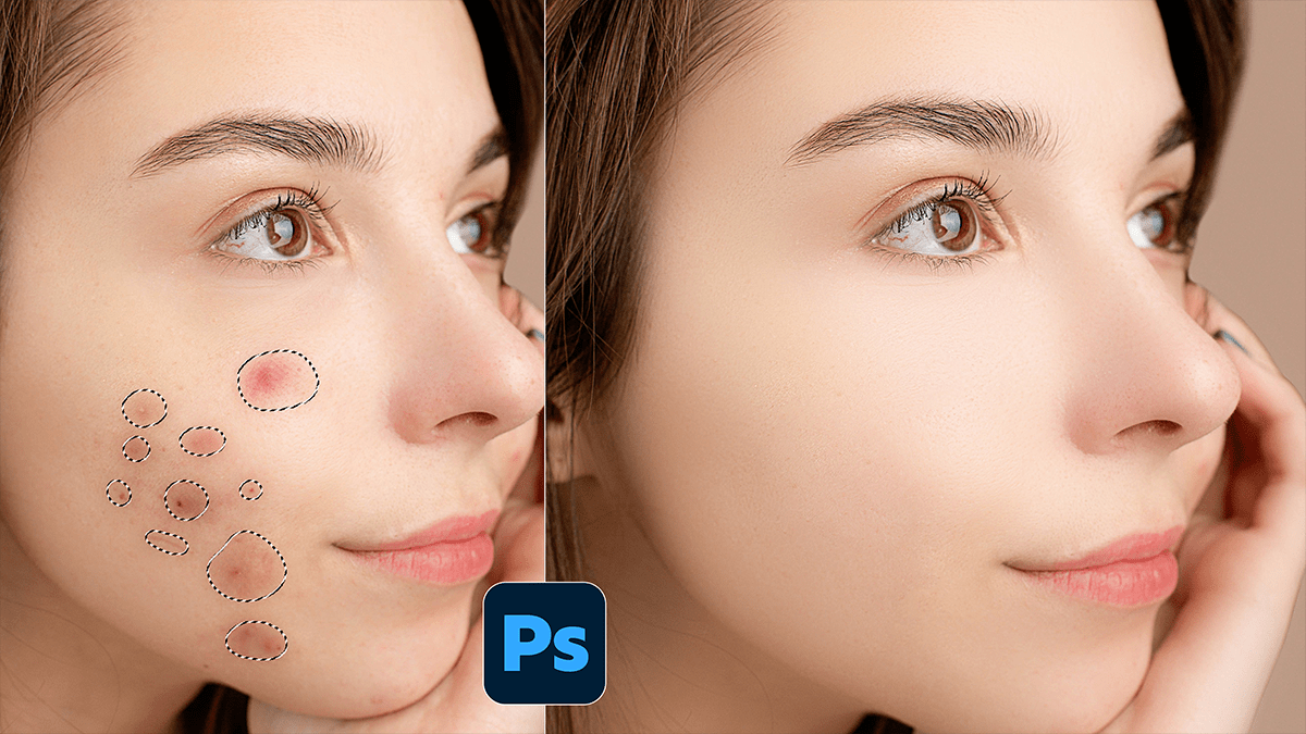 Easy Remove Pimples and Acne in Adobe Photoshop 2026